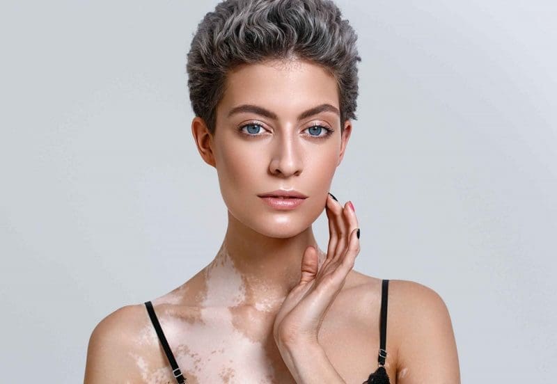 skin-pigmentation
